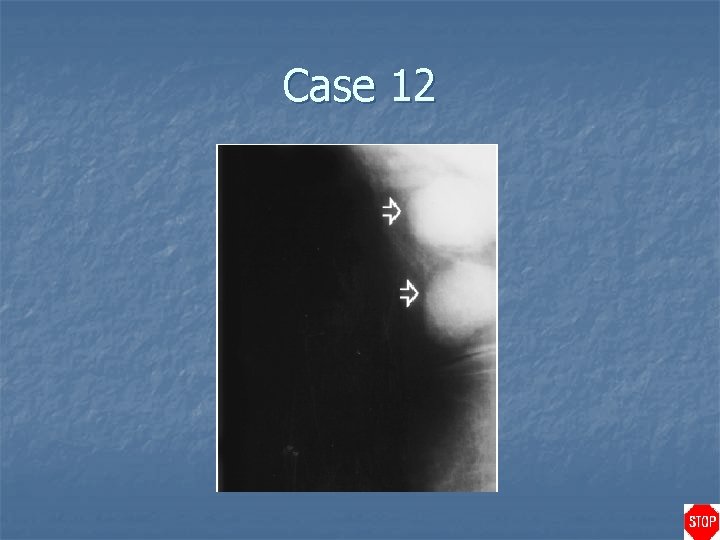 Case 12 