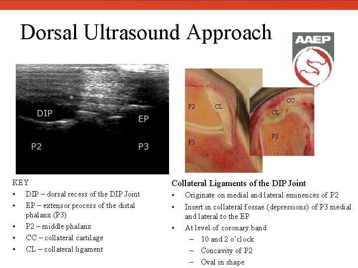  Dorsal Ultrasound Approach P 2 P 3 KEY • DIP – dorsal recess