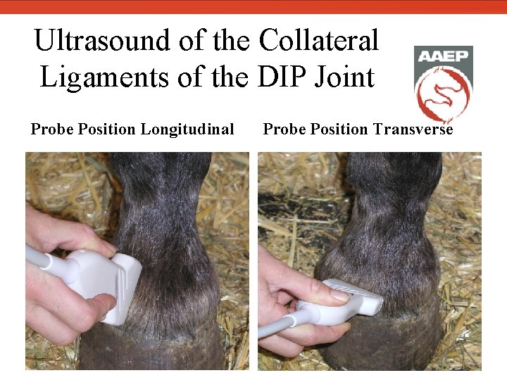  Ultrasound of the Collateral Ligaments of the DIP Joint Probe Position Longitudinal Dorsal