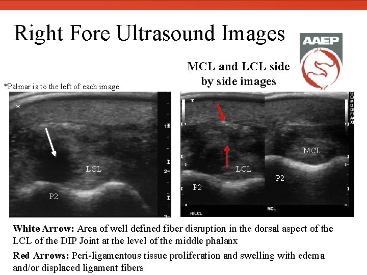  Right Fore Ultrasound Images *Palmar is to the left of each image MCL