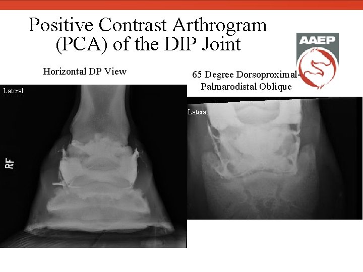  Positive Contrast Arthrogram (PCA) of the DIP Joint Horizontal DP View Lateral 65