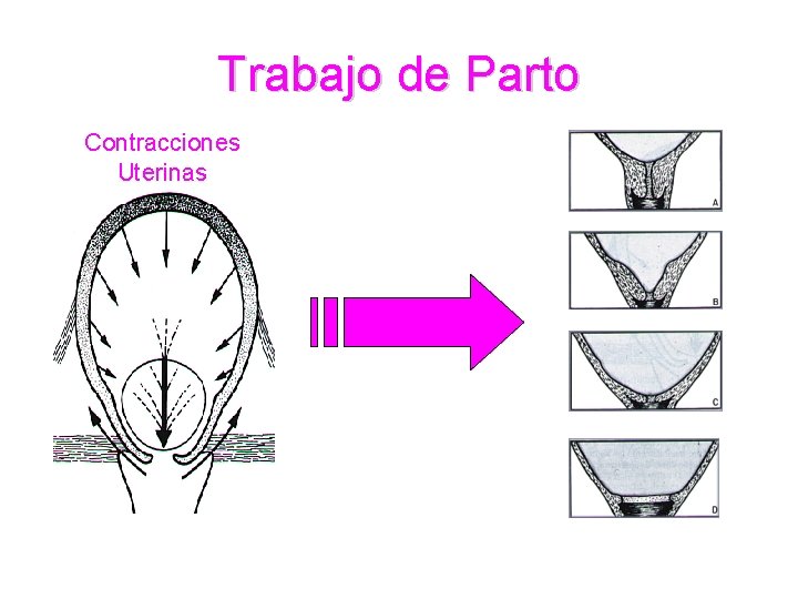 Trabajo de Parto Contracciones Uterinas Trabajo de Parto Contracciones Uterinas