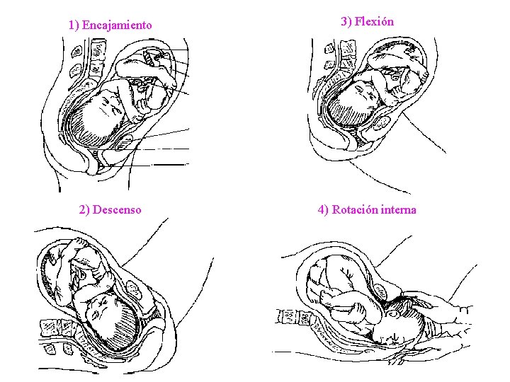 1) Encajamiento 3) Flexión 2) Descenso 4) Rotación interna 1) Encajamiento 3) Flexión 2) Descenso 4) Rotación interna