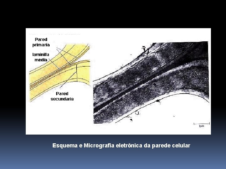 Esquema e Micrografia eletrônica da parede celular 