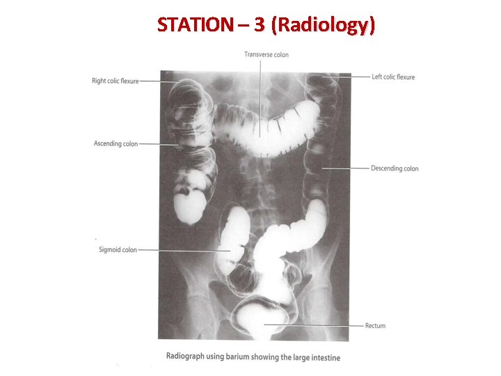 STATION – 3 (Radiology) 