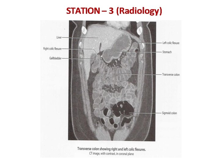 STATION – 3 (Radiology) 