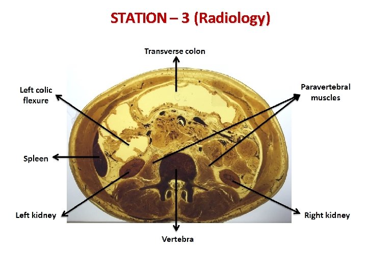 STATION – 3 (Radiology) 