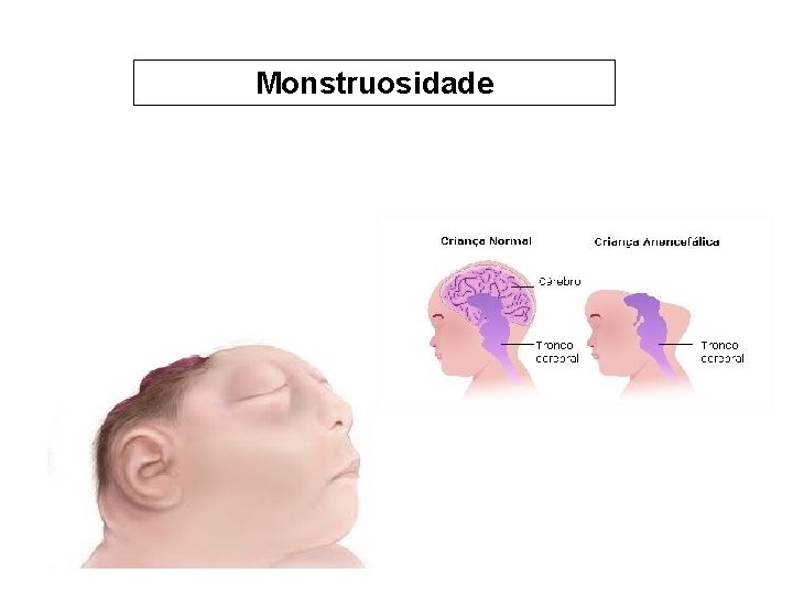 Monstruosidade 