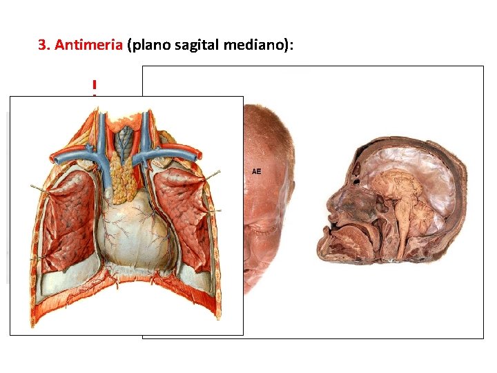 3. Antimeria (plano sagital mediano): 