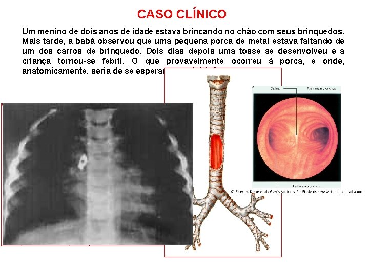 CASO CLÍNICO Um menino de dois anos de idade estava brincando no chão com