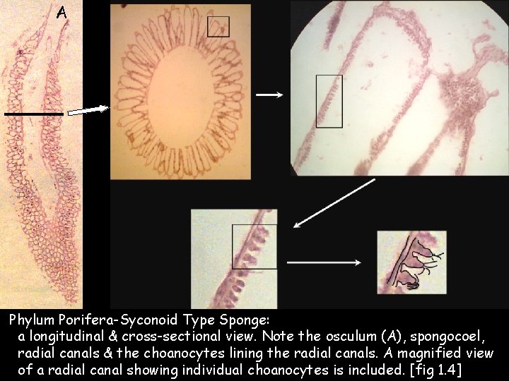 A Phylum Porifera-Syconoid Type Sponge: a longitudinal & cross-sectional view. Note the osculum (A),