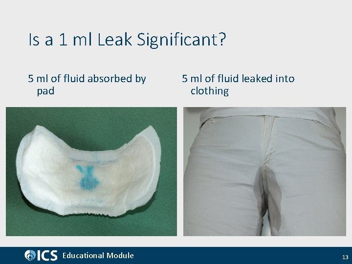 Is a 1 ml Leak Significant? 5 ml of fluid absorbed by pad Educational