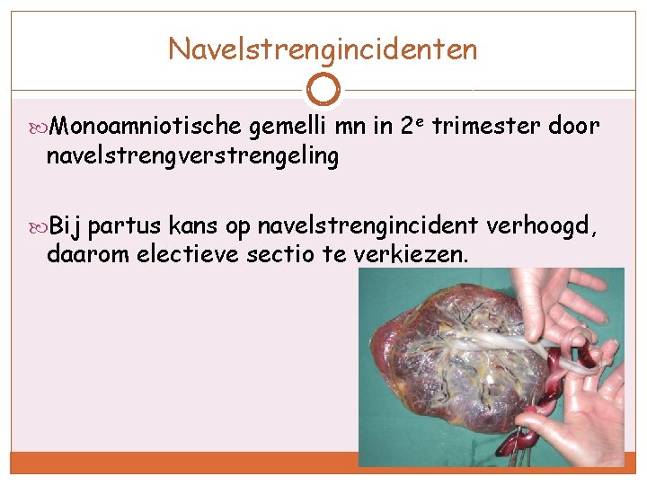 Navelstrengincidenten Monoamniotische gemelli mn in 2 e trimester door navelstrengverstrengeling Bij partus kans op