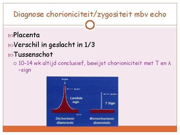 Diagnose chorioniciteit/zygositeit mbv echo Placenta Verschil in geslacht in 1/3 Tussenschot 10 -14 wk