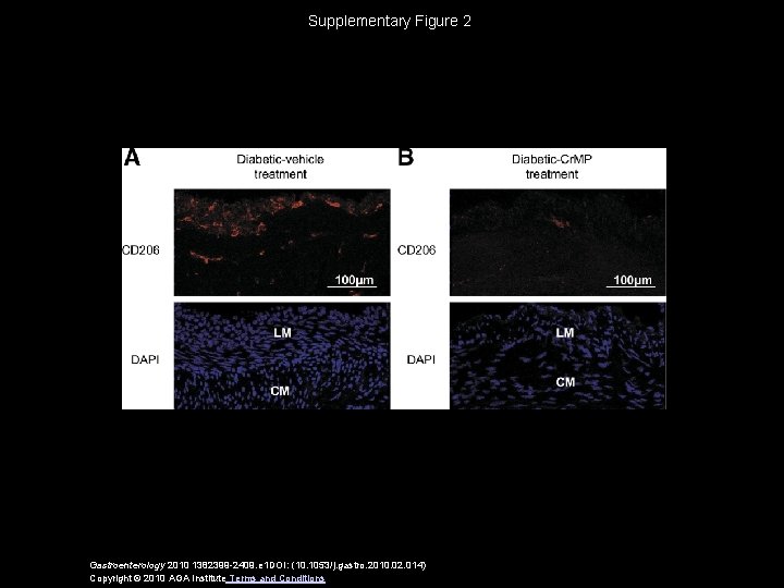 Supplementary Figure 2 Gastroenterology 2010 1382399 -2409. e 1 DOI: (10. 1053/j. gastro. 2010. Supplementary Figure 2 Gastroenterology 2010 1382399 -2409. e 1 DOI: (10. 1053/j. gastro. 2010.