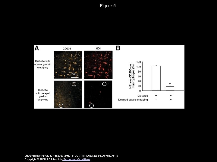 Figure 5 Gastroenterology 2010 1382399 -2409. e 1 DOI: (10. 1053/j. gastro. 2010. 02. Figure 5 Gastroenterology 2010 1382399 -2409. e 1 DOI: (10. 1053/j. gastro. 2010. 02.
