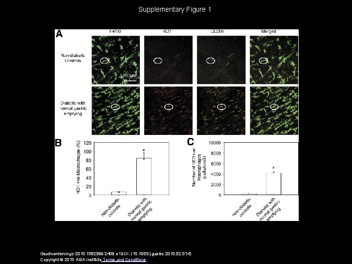 Supplementary Figure 1 Gastroenterology 2010 1382399 -2409. e 1 DOI: (10. 1053/j. gastro. 2010. Supplementary Figure 1 Gastroenterology 2010 1382399 -2409. e 1 DOI: (10. 1053/j. gastro. 2010.