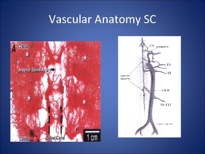 Vascular Anatomy SC 