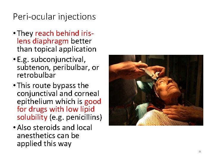 Peri-ocular injections • They reach behind irislens diaphragm better than topical application • E.