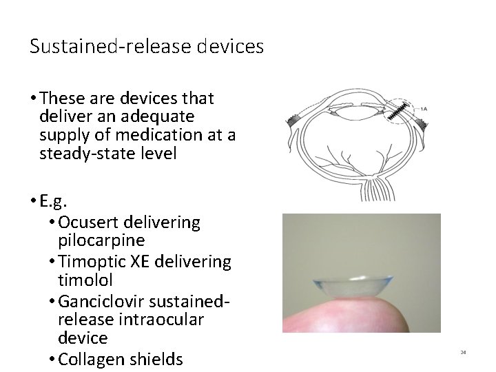 Sustained-release devices • These are devices that deliver an adequate supply of medication at