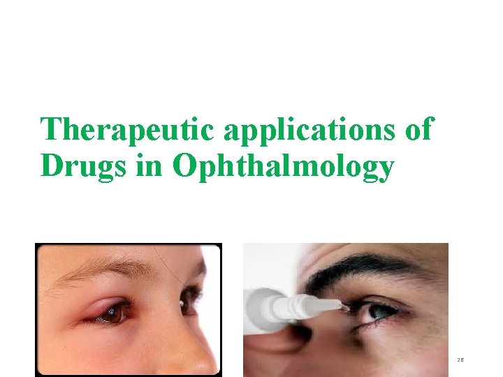 Therapeutic applications of Drugs in Ophthalmology 26 