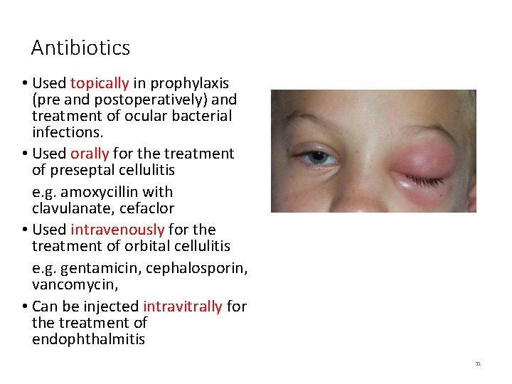 Antibiotics • Used topically in prophylaxis (pre and postoperatively) and treatment of ocular bacterial