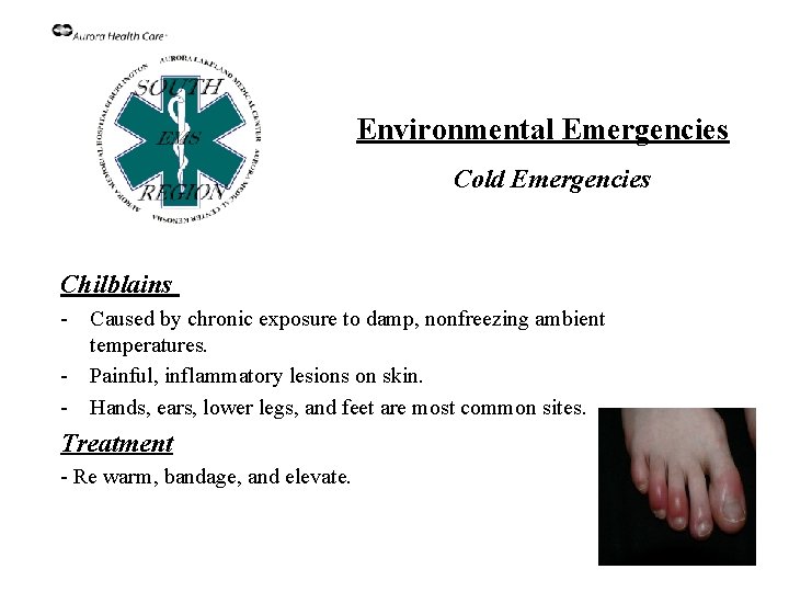 Environmental Emergencies Cold Emergencies Chilblains - Caused by chronic exposure to damp, nonfreezing ambient