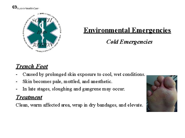 Environmental Emergencies Cold Emergencies Trench Foot - Caused by prolonged skin exposure to cool,