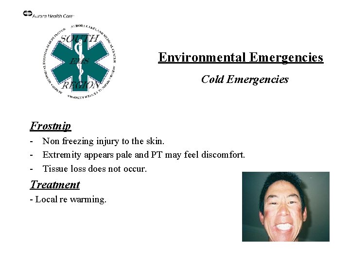 Environmental Emergencies Cold Emergencies Frostnip - Non freezing injury to the skin. - Extremity