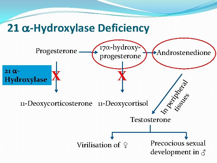 21 -Hydroxylase Deficiency 21 Hydroxylase X 17 -hydroxyprogesterone X 11 -Deoxycorticosterone 11 -Deoxycortisol Androstenedione