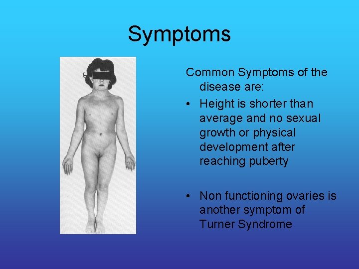 Symptoms Common Symptoms of the disease are: • Height is shorter than average and