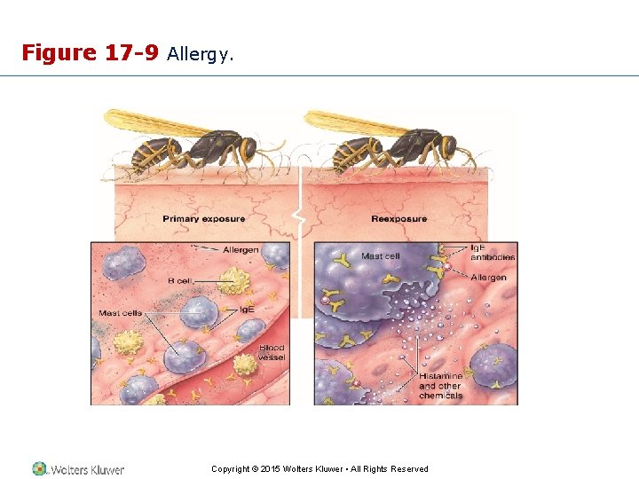 Figure 17 -9 Allergy. Copyright © 2015 Wolters Kluwer • All Rights Reserved 
