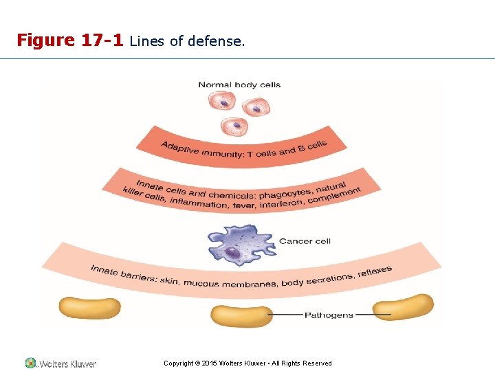Figure 17 -1 Lines of defense. Copyright © 2015 Wolters Kluwer • All Rights