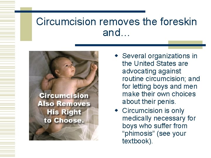 Circumcision removes the foreskin and… w Several organizations in the United States are advocating