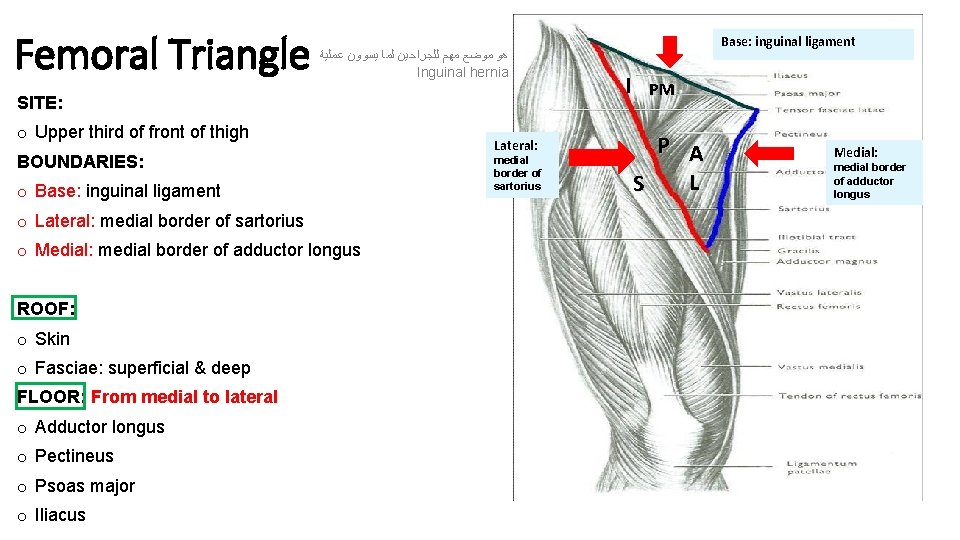 Femoral Triangle ﻋﻤﻠﻴﺔ ﻳﺴﻮﻭﻥ ﻟﻤﺎ ﻟﻠﺠﺮﺍﺣﻴﻦ ﻣﻬﻢ ﻣﻮﺿﻊ ﻫﻮ Inguinal hernia SITE: o Upper