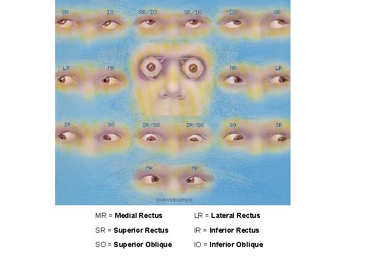 MR = Medial Rectus LR = Lateral Rectus SR = Superior Rectus IR =
