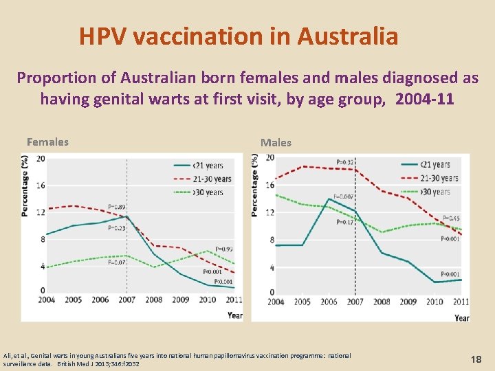 HPV vaccination in Australia Proportion of Australian born females and males diagnosed as having