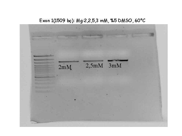 Exon 1(1509 bç): Mg: 2, 2, 5, 3 m. M, %5 DMSO, 60ºC 2
