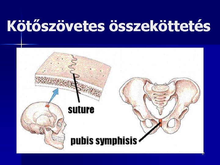 Kötőszövetes összeköttetés 17 