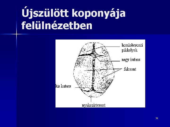 Újszülött koponyája felülnézetben 36 