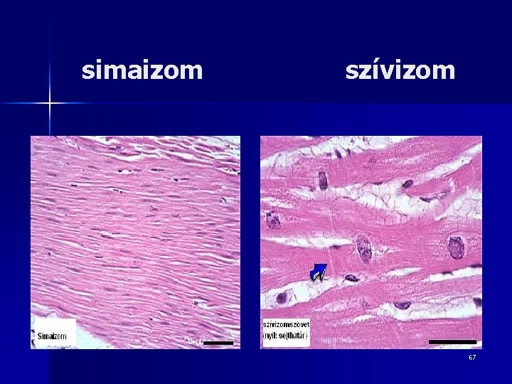 simaizom szívizom 67 