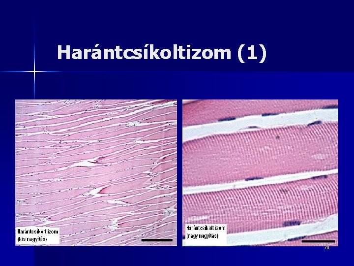 Harántcsíkoltizom (1) 70 