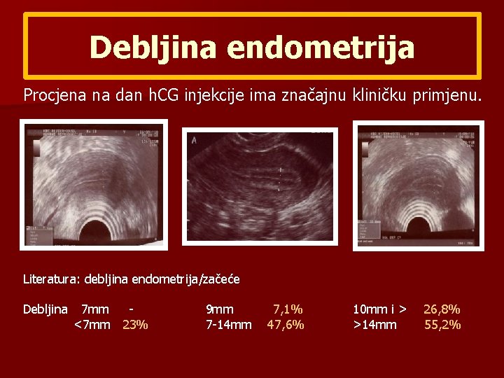 Debljina endometrija Procjena na dan h. CG injekcije ima značajnu kliničku primjenu. Literatura: debljina