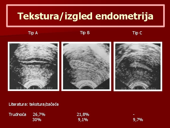 Tekstura/izgled endometrija Tip A Tip B Tip C 21, 8% 9, 1% 9, 7%