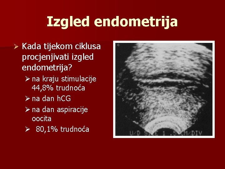 Izgled endometrija Ø Kada tijekom ciklusa procjenjivati izgled endometrija? Ø na kraju stimulacije 44,