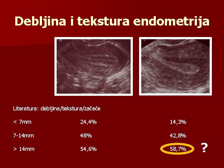 Debljina i tekstura endometrija Literatura: debljina/tekstura/začeće < 7 mm 24, 4% 14, 3% 7
