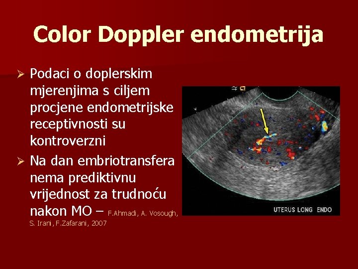 Color Doppler endometrija Podaci o doplerskim mjerenjima s ciljem procjene endometrijske receptivnosti su kontroverzni
