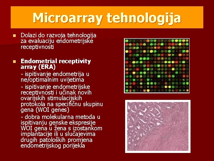 Microarray tehnologija n Dolazi do razvoja tehnologija za evaluaciju endometrijske receptivnosti n Endometrial receptivity