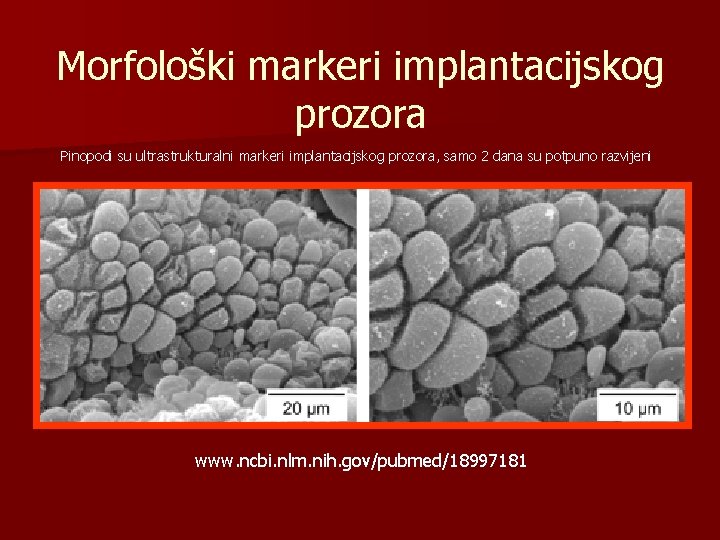 Morfološki markeri implantacijskog prozora Pinopodi su ultrastrukturalni markeri implantacijskog prozora, samo 2 dana su