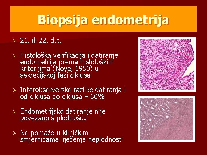 Biopsija endometrija Ø 21. ili 22. d. c. Ø Histološka verifikacija i datiranje endometrija